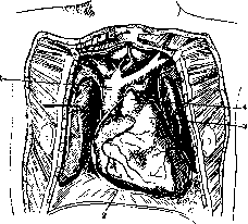 Pericardium: figure 2 from the 1928–1936 encyclopedia article