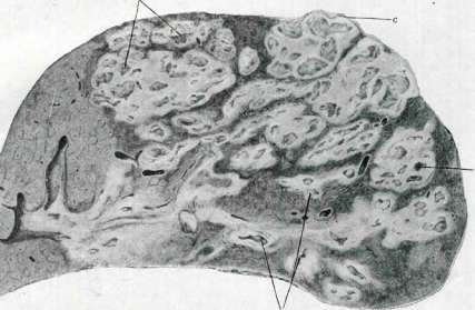 Liver: figure 28 from the 1928–1936 encyclopedia article