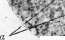 Liver: figure 5 from the 1928–1936 encyclopedia article