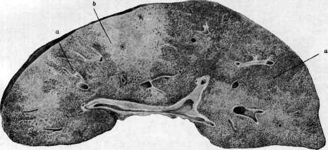 Liver: figure 31 from the 1928–1936 encyclopedia article