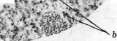 Liver: figure 6 from the 1928–1936 encyclopedia article