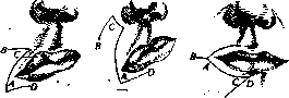 Plasteins: figure 9 from the 1928–1936 encyclopedia article