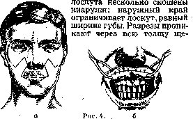 Plasteins: figure 3 from the 1928–1936 encyclopedia article
