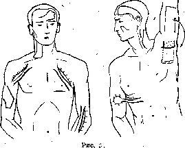 Plasteins: figure 2 from the 1928–1936 encyclopedia article
