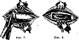 Pleurisy: figure 10 from the 1928–1936 encyclopedia article