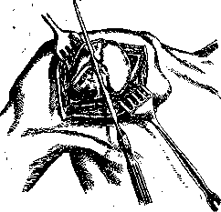 Shoulder Joint: figure 9 from the 1928–1936 encyclopedia article