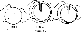 Shoulder Joint: figure 1 from the 1928–1936 encyclopedia article