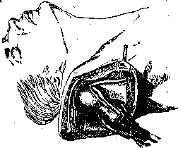 Shoulder Joint: figure 16 from the 1928–1936 encyclopedia article