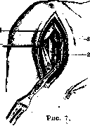 Shoulder Joint: figure 7 from the 1928–1936 encyclopedia article