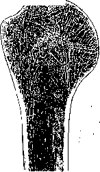 Brachium: figure 2 from the 1928–1936 encyclopedia article