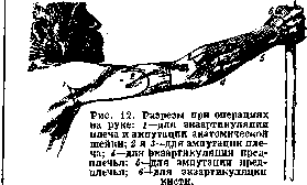Brachium: figure 11 from the 1928–1936 encyclopedia article