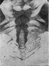 Fetus: figure 10 from the 1928–1936 encyclopedia article