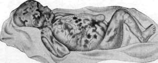 Fetus: figure 11 from the 1928–1936 encyclopedia article