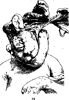 Fetus: figure 23 from the 1928–1936 encyclopedia article