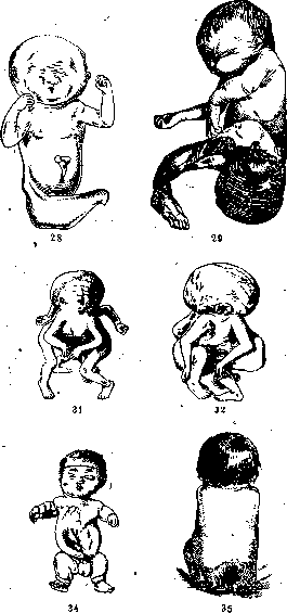 Fetus: figure 24 from the 1928–1936 encyclopedia article