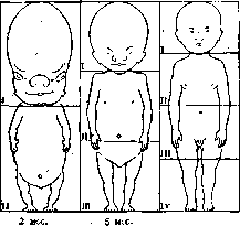 Fetus: figure 3 from the 1928–1936 encyclopedia article