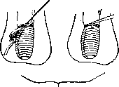 Penis: figure 11 from the 1928–1936 encyclopedia article