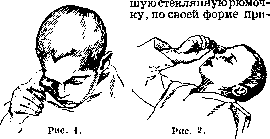 Compresses: figure 1 from the 1928–1936 encyclopedia article