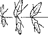 Prognathism (PROGNATHISM, PROGNATHIA, is secondary as a): figure 1 from the 1928–1936 encyclopedia article
