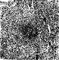 Pseudotuberculosis: figure 2 from the 1928–1936 encyclopedia article