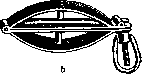 Umbilical Cord: figure 13 from the 1928–1936 encyclopedia article