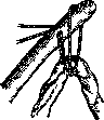 Umbilical Cord: figure 7 from the 1928–1936 encyclopedia article