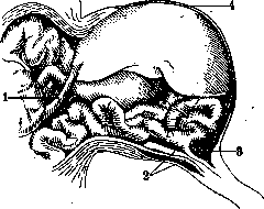 Umbilical Cord: figure 4 from the 1928–1936 encyclopedia article
