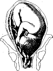 Umbilical Cord: figure 6 from the 1928–1936 encyclopedia article