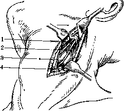 Neurotomy: figure 1 from the 1928–1936 encyclopedia article