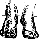 Neurotomy: figure 7 from the 1928–1936 encyclopedia article
