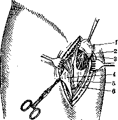 Neurotomy: figure 8 from the 1928–1936 encyclopedia article