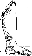 Neurotomy: figure 5 from the 1928–1936 encyclopedia article