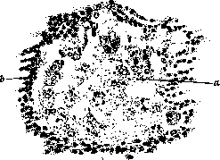 Necrosis: figure 1 from the 1928–1936 encyclopedia article