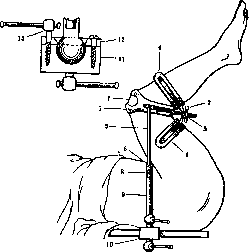 Operating Tables: figure 19 from the 1928–1936 encyclopedia article