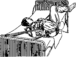 Operating Tables: figure 21 from the 1928–1936 encyclopedia article