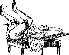 Operating Tables: figure 18 from the 1928–1936 encyclopedia article