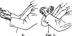 Otolith Apparatus: figure 3 from the 1928–1936 encyclopedia article
