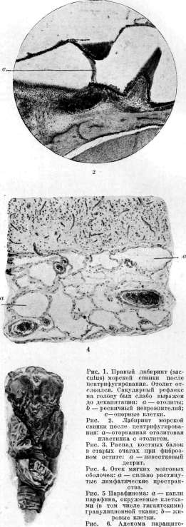 Otolith Apparatus: figure 7 from the 1928–1936 encyclopedia article