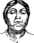 Ophthalmoplegia: figure 1 from the 1928–1936 encyclopedia article