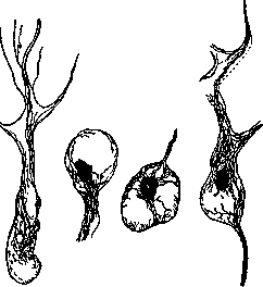 Amaurotic Family Idiocy: figure 1 from the 1928–1936 encyclopedia article