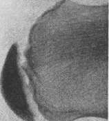 Apostoli Condenser Bed: figure 5 from the 1928–1936 encyclopedia article