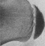 Apostoli Condenser Bed: figure 4 from the 1928–1936 encyclopedia article
