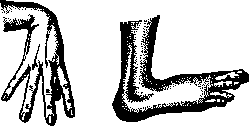 Arachnodactyly: figure 1 from the 1928–1936 encyclopedia article
