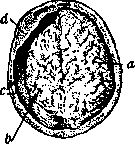 Atrophy: figure 1 from the 1928–1936 encyclopedia article