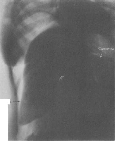 Aerobes: figure 2 from the 1928–1936 encyclopedia article