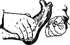 Babinski Reflex: figure 2 from the 1928–1936 encyclopedia article
