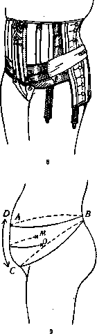 Bandages (a198): figure 8 from the 1928–1936 encyclopedia article