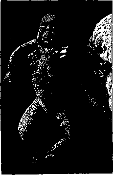 Barlow's Disease: figure 2 from the 1928–1936 encyclopedia article