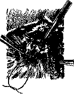 Billroth Operations on the Stomach: figure 5 from the 1928–1936 encyclopedia article