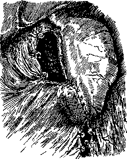 Billroth Operations on the Stomach: figure 3 from the 1928–1936 encyclopedia article